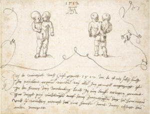 „Elßgred“ war kein Vorbote drohenden Unheils: Albrecht Dürer (1471–1528); Die siamesischen Zwillinge von Ertingen, 1512; Feder in Schwarz, 158 x 209 mm; The Ashmolean Museum, Oxford