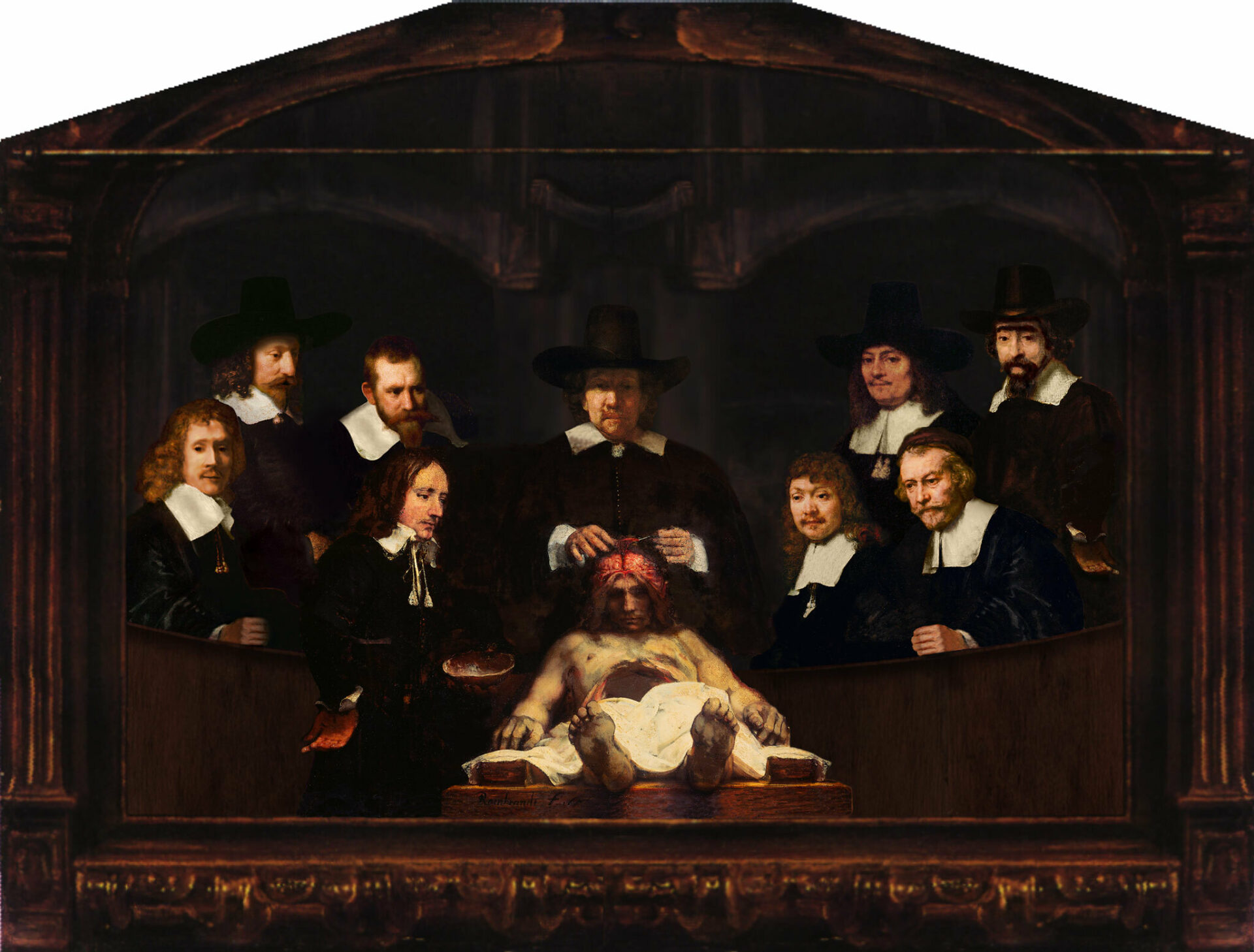 2025 NM Rembrandt Anatomy Lesson 2